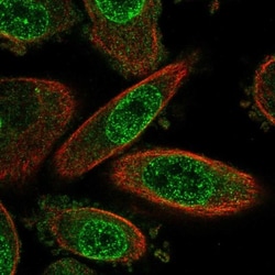 Meteorin Antibody, Novus Biologicals 0.1mL; Unlabeled:Antibodies, Polyclonal